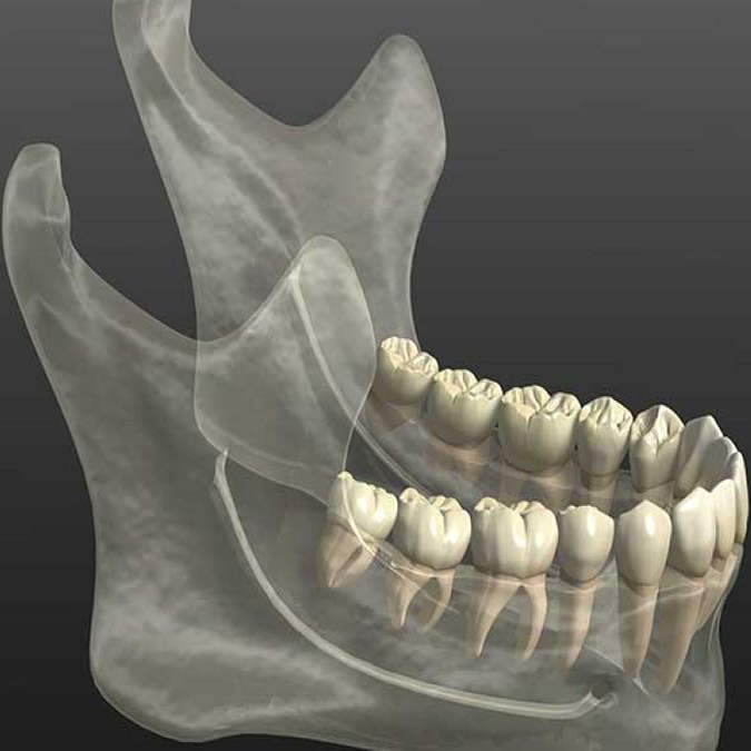 teeth and bone health picture