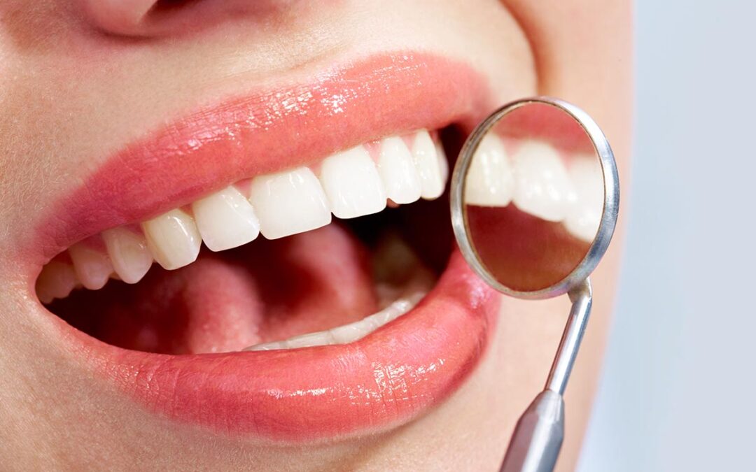 mouth and gums smile image